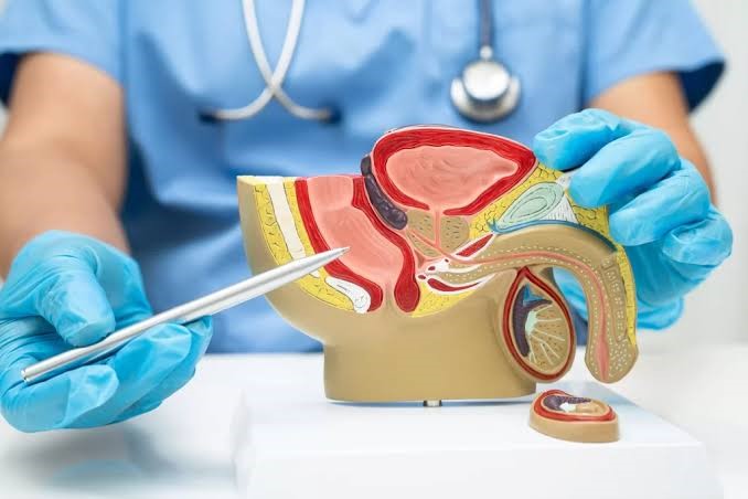 Prostate Treatment